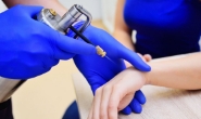 Cryo Skin Cancers & Melanomas - 11