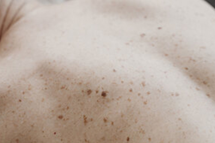 TSC Waiting room 1 1 Summer is officially here - time for a skin check! - 12