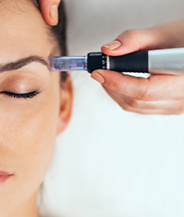 RF Microneedling
